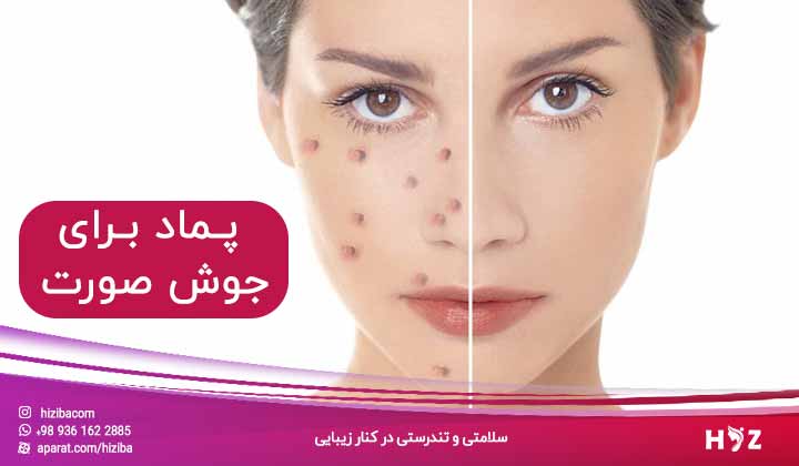کرم ضد جوش فوری چطور می تواند موثر باشد؟