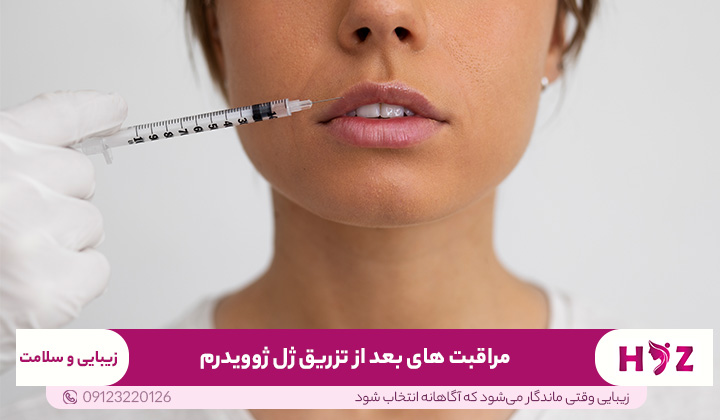 مراقبت های بعد از تزریق ژل ژوویدرم