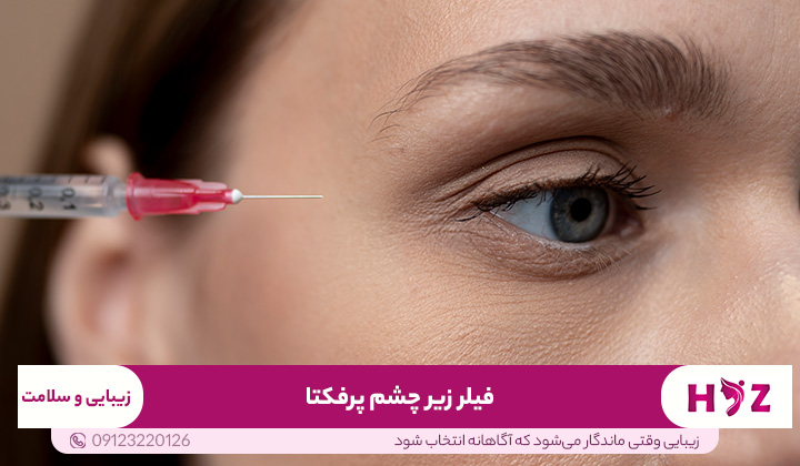 فیلر زیر چشم پرفکتا