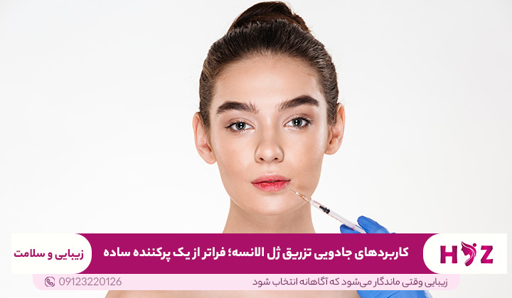 کاربردهای جادویی تزریق ژل الانسه؛ فراتر از یک پرکننده ساده