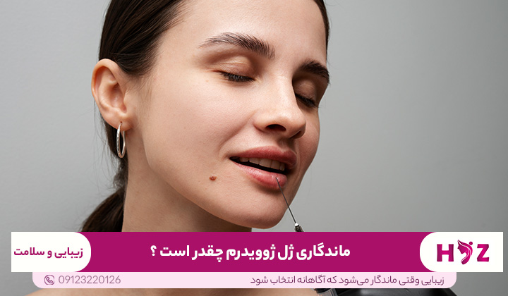 ماندگاری ژل ژوویدرم چقدر است ؟