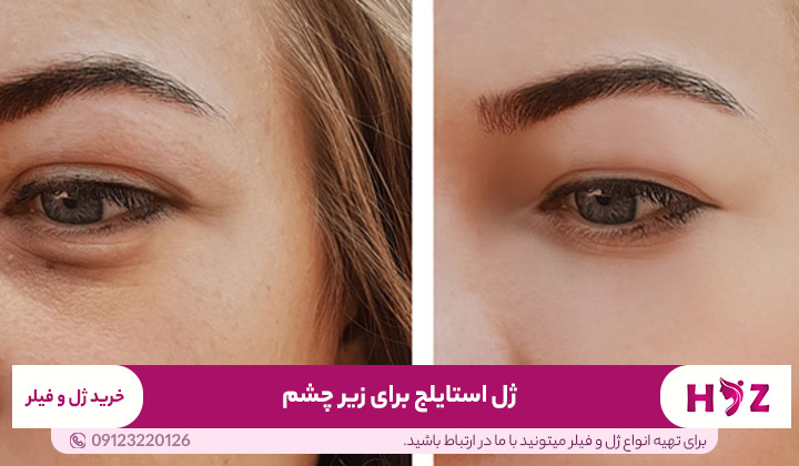 ژل استایلج برای زیر چشم 