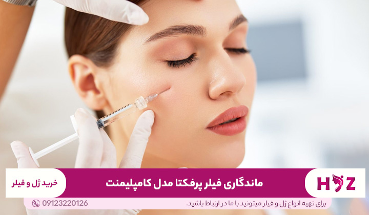 ماندگاری فیلر پرفکتا مدل کامپلیمنت